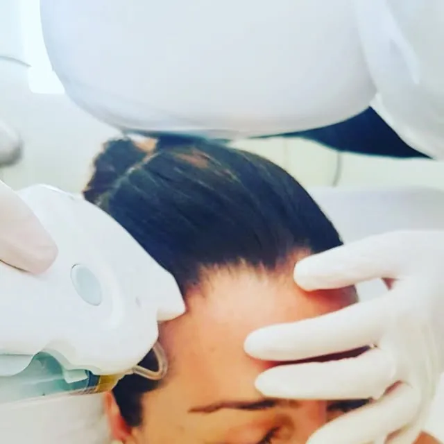 Tratamiento de aparatología facial en Abisthetic